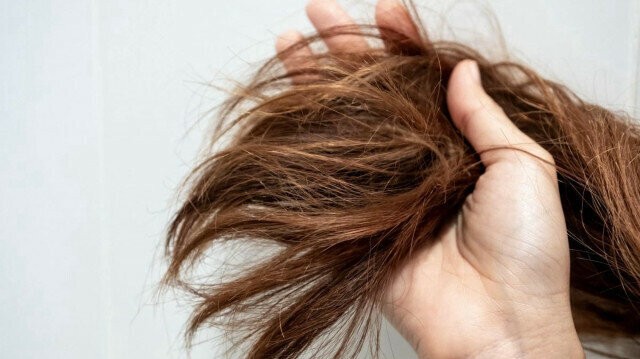 Soğuk Havalarda Saç Kuruluğuyla Mücadele Yolları