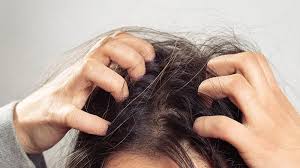 Saç Derisi Sağlığı: Kepek ve Kaşıntıya Karşı Etkili Çözümler