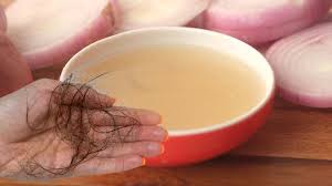 Saç Dökülmesini Önlemek İçin Doğal ve Etkili Yöntemler